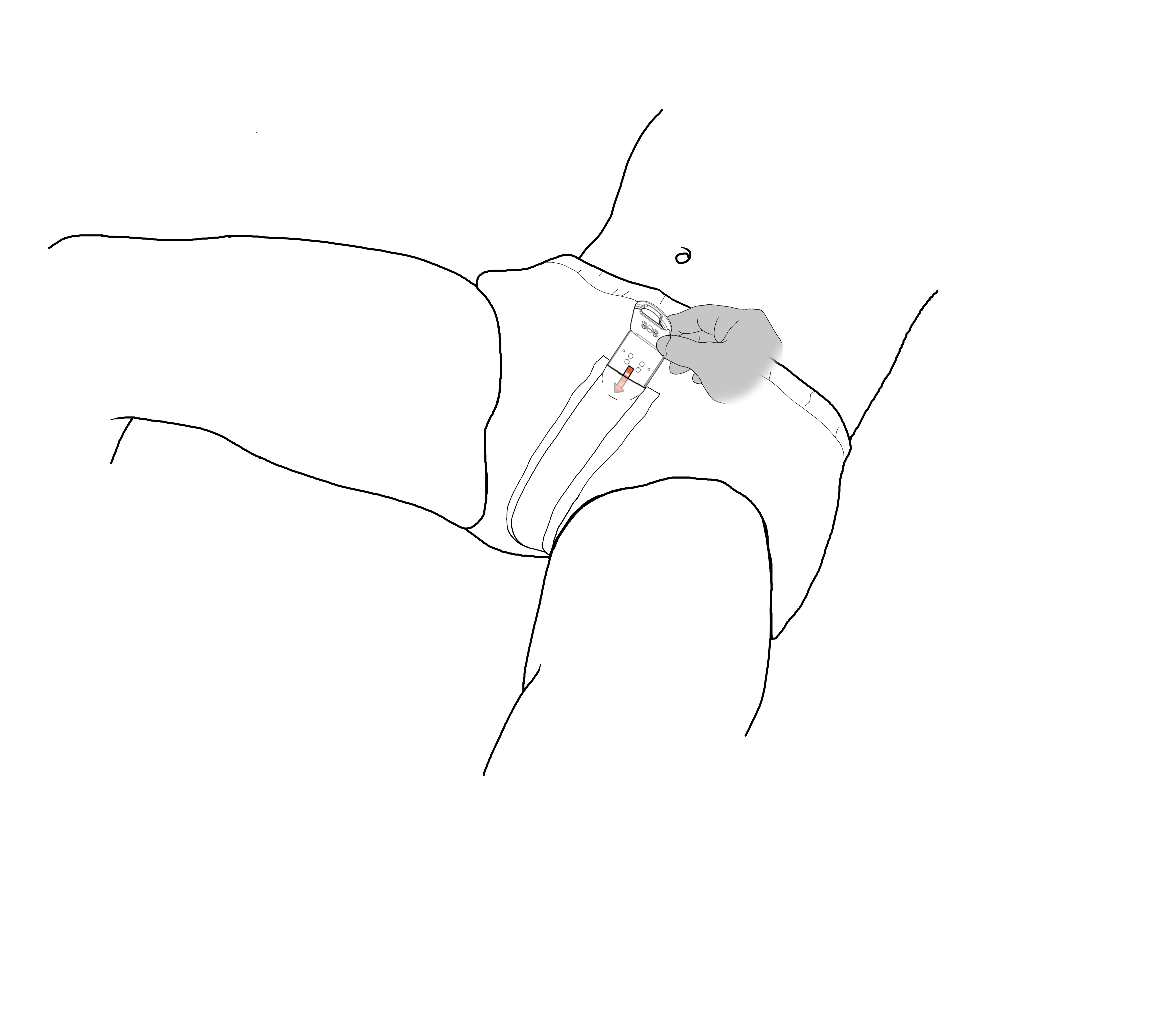 ICP on human with clip 2 (1).png